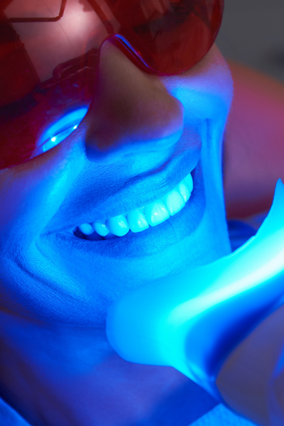 WHAT OPTIONS ARE AVAILABLE FOR TEETH WHITENING?