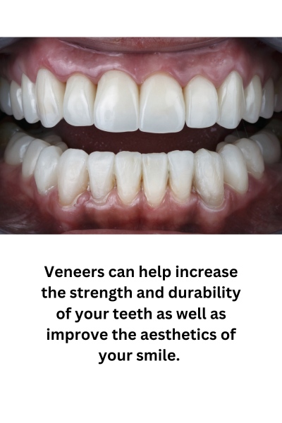 WHO IS A GOOD CANDIDATE FOR VENEERS?