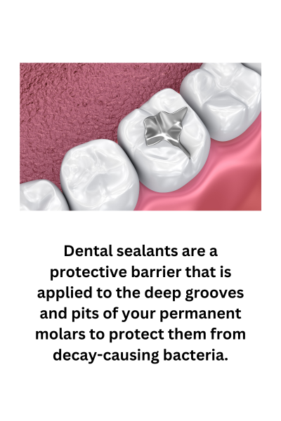 Dental sealants are a protective barrier that is applied to the deep grooves and pits of your permanent molars to protect them from decay-causing bacteria.