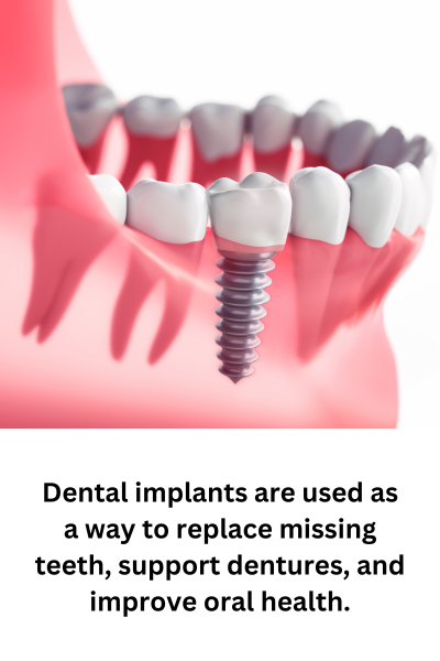 Dental implants are used as a way to replace missing teeth, support dentures, and improve oral health.