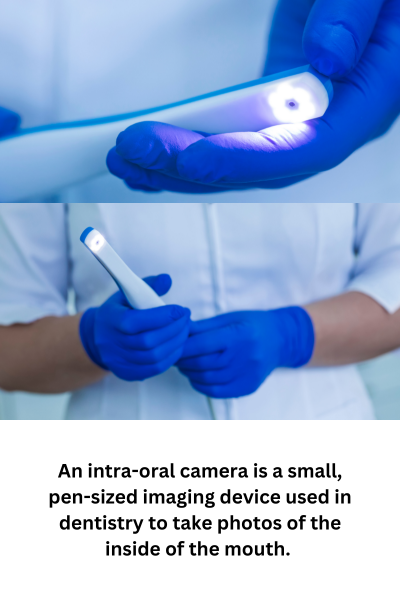 An intra-oral camera is a small, pen-sized imaging device used in dentistry to take photos of the inside of the mouth.