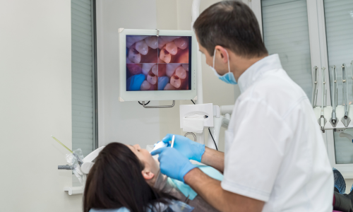 An intraoral camera is a small, handheld dental instrument that takes still and video images of a tooth and the surrounding oral region.