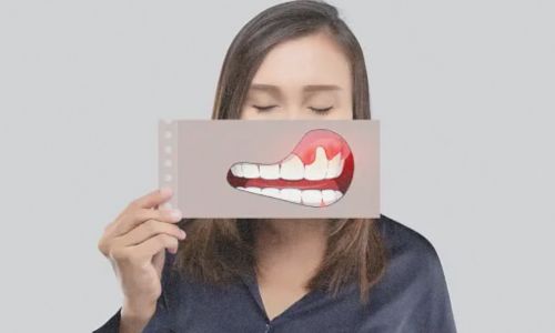The Silent Threat: Signs and Symptoms of Gum Diseases