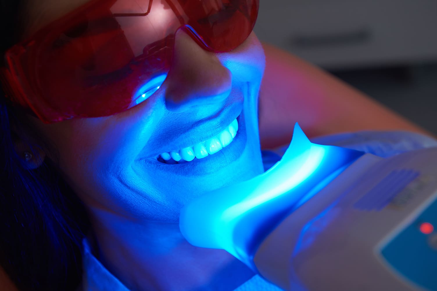 Professional vs. OTC Teeth Whitening: Making the Choice