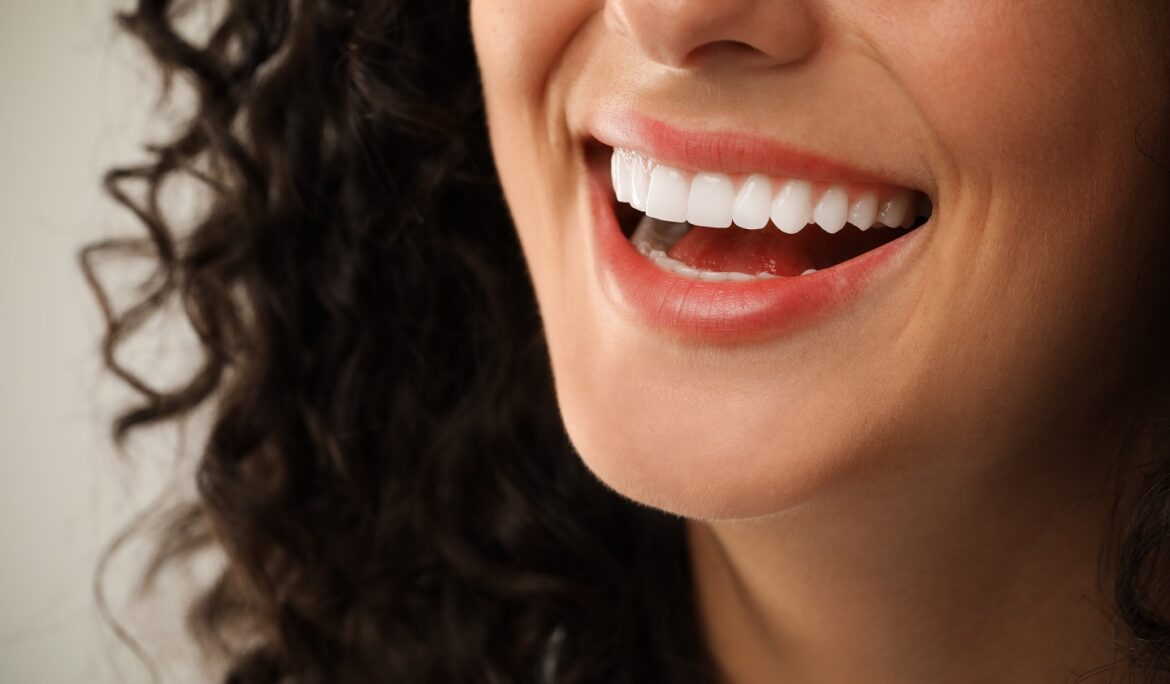 How Long Does Teeth Whitening Last? Expert Tips