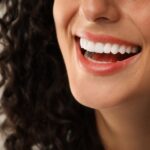 How Long Does Teeth Whitening Last? Expert Tips